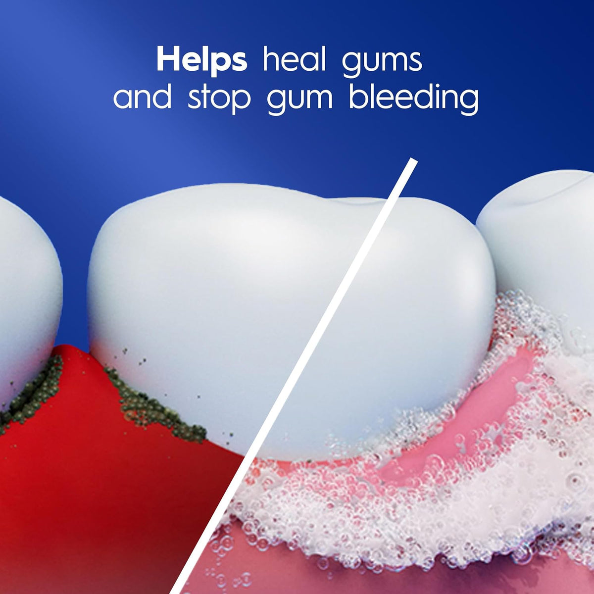 Crest Pro-Health Gum & Enamel Restore Toothpaste 4.8 oz Anticavity, Antibacterial Flouride Toothpaste, Clinically Proven, Gum, Sensitivity, and Enamel Protection